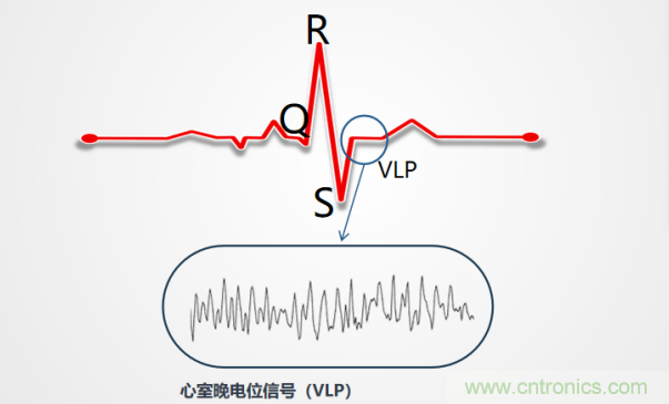 解決心電監(jiān)測行業(yè)難題，曼森伯格的濾波技術(shù)獲國家知識產(chǎn)權(quán)局發(fā)明授權(quán)